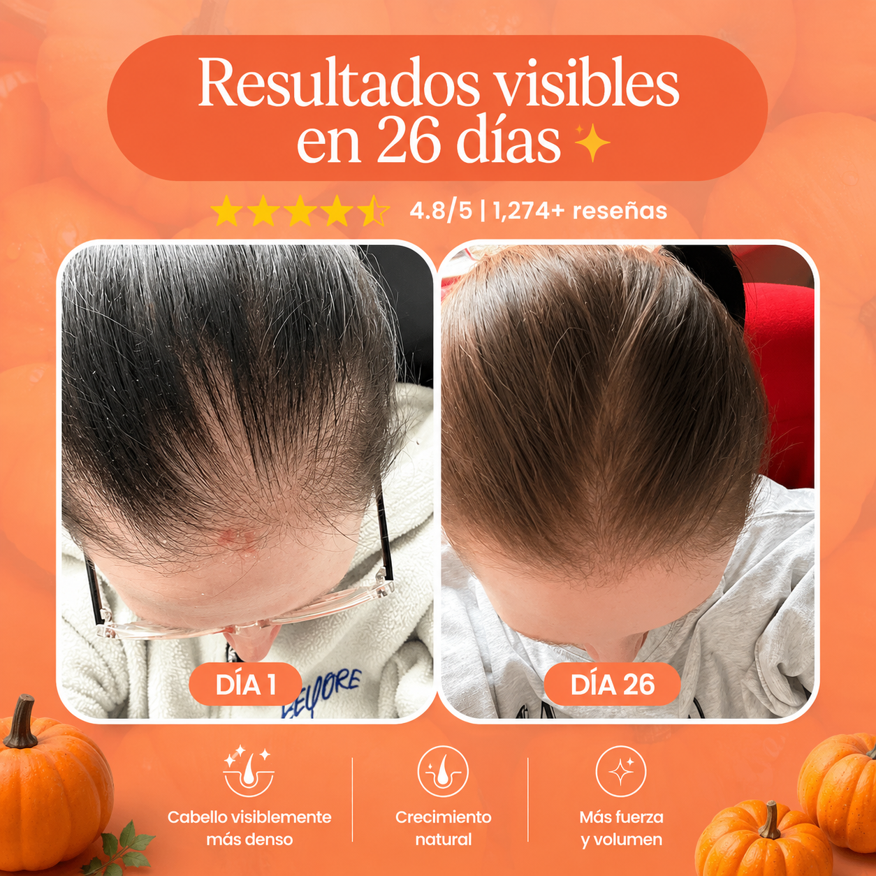 Frasco Folivex crecimiento capilar