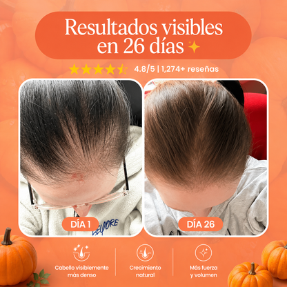 Frasco Folivex crecimiento capilar
